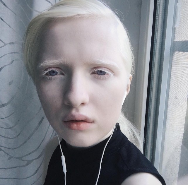 Albinos: Kiker Chan