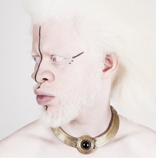 Albinos : Jewell Jeffrey