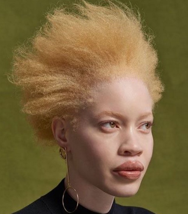 Albinos : Diandra Forest