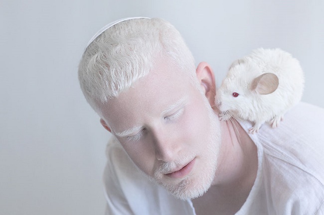 Albinos : concours de beauté