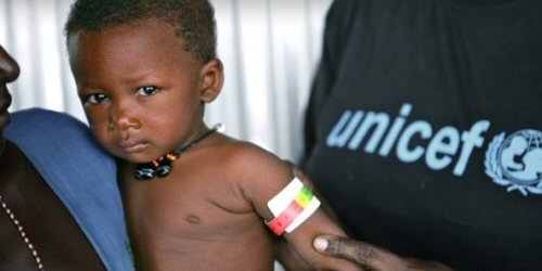 malnutrition enfant au cameroun